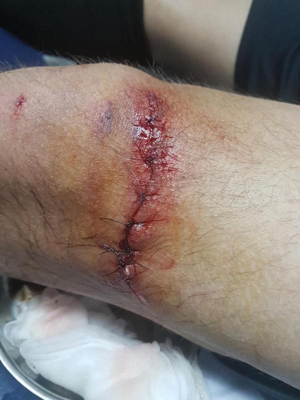 58444827_2317324668290745_3052454994096685056_n.jpg - (FOTO)